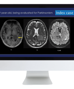 Case Review of Neuroradiology