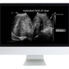 Case Review of Ultrasound