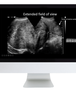 Case Review of Ultrasound