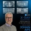 OHI-S X-ray in Dentistry: From Analog to 3D Methods