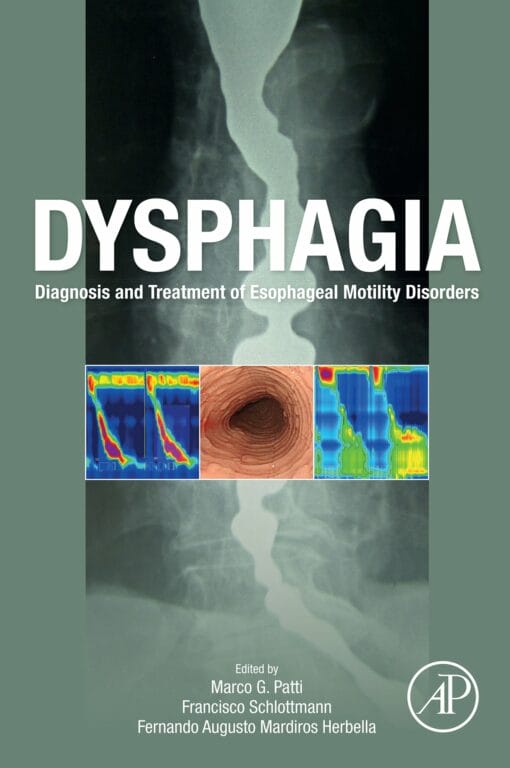 Dysphagia: Diagnosis And Treatment Of Esophageal Motility Disorders (EPUB)