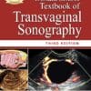 Donald School Textbook of Transvaginal Sonography 3rd ed. Edition (PDF)