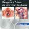 Laparoscopic Management of Prolapse and Stress Urinary Incontinence 1st Edition (PDF)