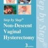 Step by Step: Non-Descent Vaginal Hysterectomy (PDF)