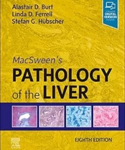 MacSween’s Pathology Of The Liver, 8th Edition (PDF)