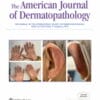American Journal of Dermatopathology: Volume 45 (1 – 12) 2023 PDF