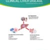 Clinical Liver Disease: Volume 20 (1 – 6) 2022 PDF