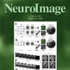 NeuroImage: Volume 265 to Volume 284 2023 PDF