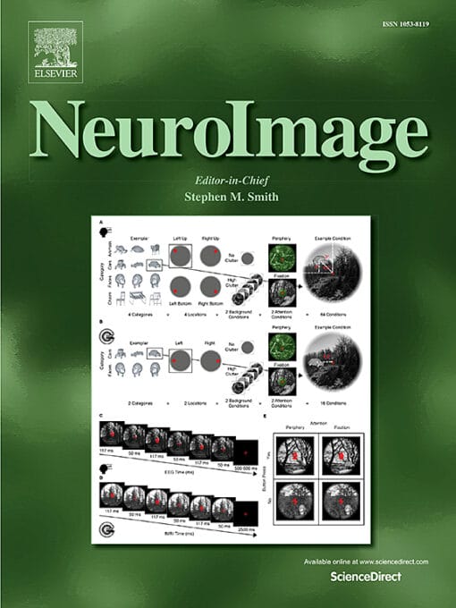 NeuroImage: Volume 265 to Volume 284 2023 PDF