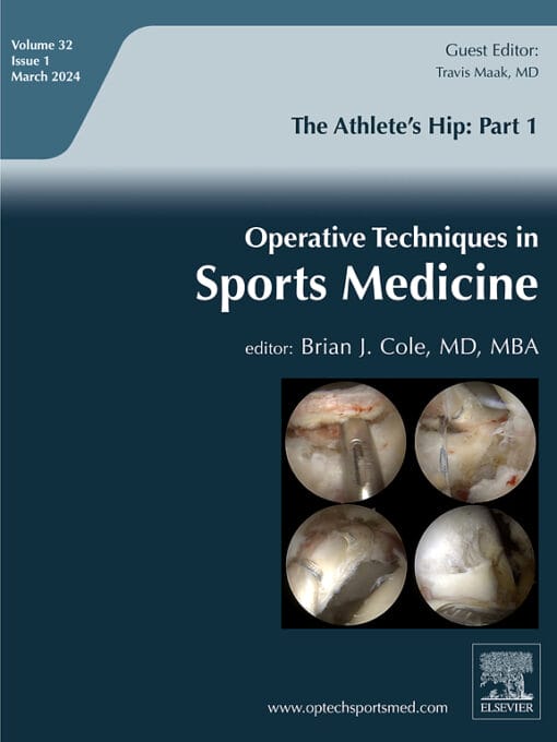 Operative Techniques in Sports Medicine: Volume 32, Issue 1 2024 PDF