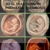 3D Ultrasound in Prenatal Diagnosis: A Practical Approach 2nd edition (PDF)