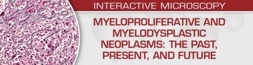 Myeloproliferative and Myelodysplastic Neoplasms: The Past, Present, and Future 2024