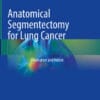 Anatomical Segmentectomy for Lung Cancer
Illustration and Videos