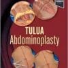 TULUA Abdominoplasty: Transverse Plication Technique (EPUB + Converted PDF)