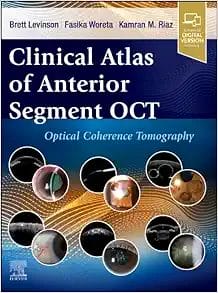 Clinical Atlas Of Anterior Segment OCT: Optical Coherence Tomography (PDF)