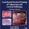 Case-Based Practical Training Of Colposcopy And Cervical Pathology: With Diagrams And Images (PDF)