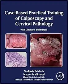 Case-Based Practical Training Of Colposcopy And Cervical Pathology: With Diagrams And Images (PDF)