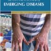 The Gale Encyclopedia Of Emerging Diseases, 2nd Edition (EPUB)