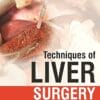 Techniques of Liver Surgery (PDF)