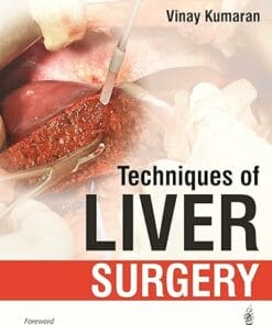 Techniques of Liver Surgery (PDF)